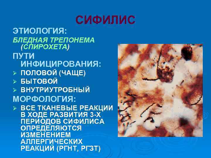 ЭТИОЛОГИЯ: СИФИЛИС БЛЕДНАЯ ТРЕПОНЕМА (СПИРОХЕТА) ПУТИ ИНФИЦИРОВАНИЯ: Ø Ø Ø ПОЛОВОЙ (ЧАЩЕ) БЫТОВОЙ ВНУТРИУТРОБНЫЙ