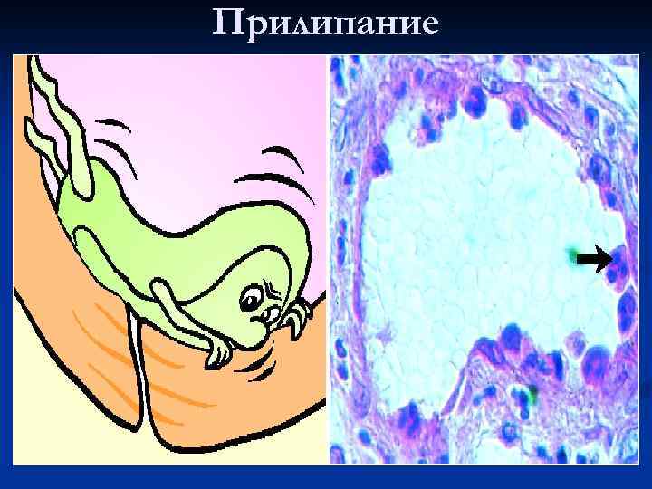 Прилипание 