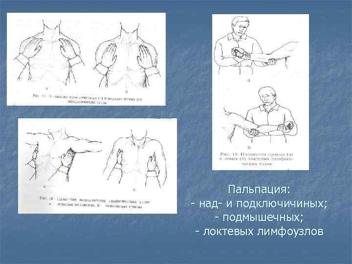 Пальпация: - над- и подключичиных; - подмышечных; - локтевых лимфоузлов 