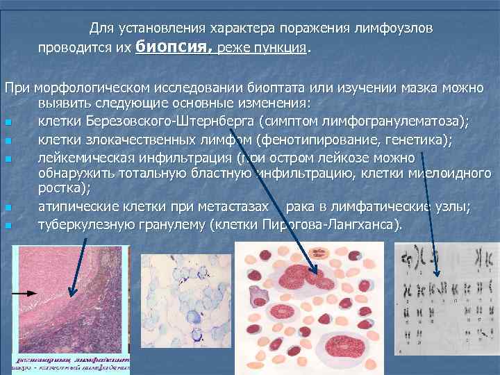Для установления характера поражения лимфоузлов проводится их биопсия, реже пункция. При морфологическом исследовании биоптата