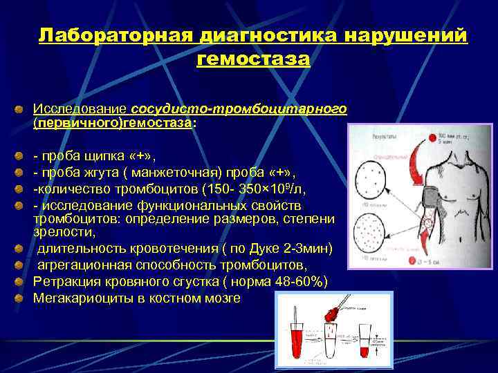 Лабораторная диагностика нарушений гемостаза Исследование сосудисто-тромбоцитарного (первичного)гемостаза: - проба щипка «+» , - проба