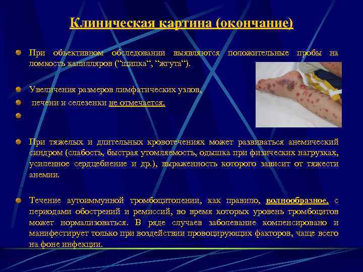 Клиническая картина (окончание) При объективном обследовании выявляются положительные пробы на ломкость капилляров (“щипка“, “жгута“).