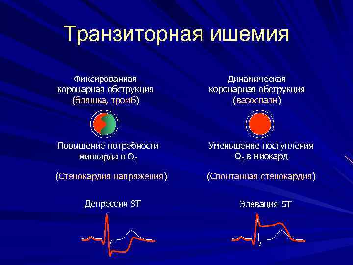 Транзиторная ишемия Фиксированная коронарная обструкция (бляшка, тромб) Динамическая коронарная обструкция (вазоспазм) Повышение потребности миокарда