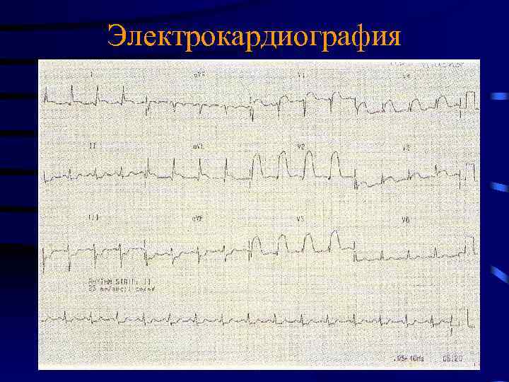Электрокардиография 
