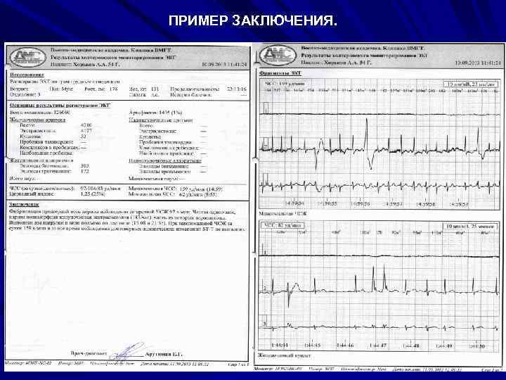 ПРИМЕР ЗАКЛЮЧЕНИЯ. 