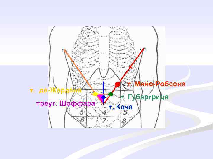 т. де-Жардена треуг. Шоффара т. Мейо-Робсона т. Губергрица т. Кача 