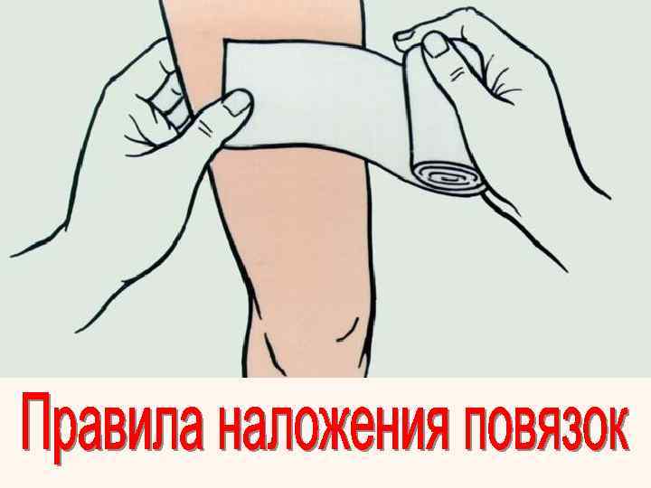 При наложении повязок необходимо придерживаться следующих правил:    Ø бинтовать в наиболее