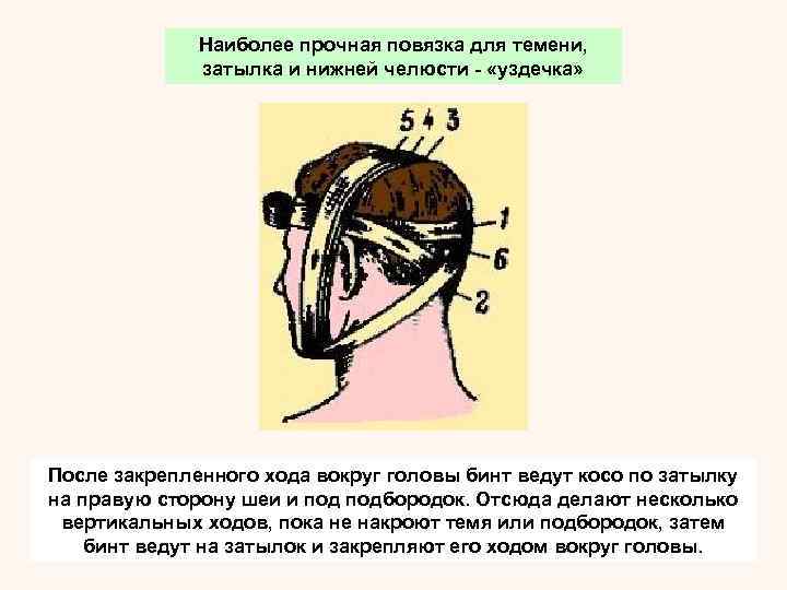 При бинтовании подбородка к этой повязке делают дополнительные  ходы. После закрепляющего хода вокруг