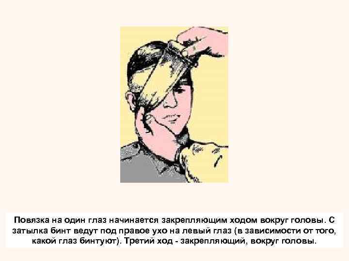 При бинтовании левого глаза удобнее держать бинт в левой руке и вести его справа
