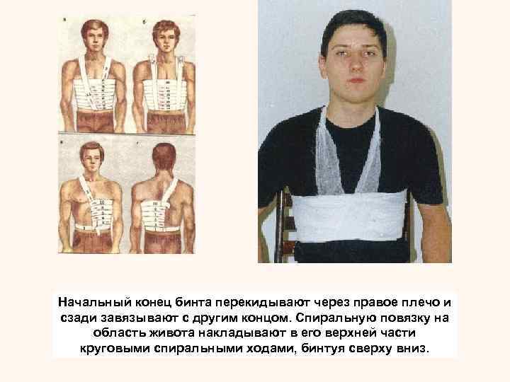  Колосовидную повязку накладывают на нижнюю часть живота, паховую область, верхнюю часть бедра и