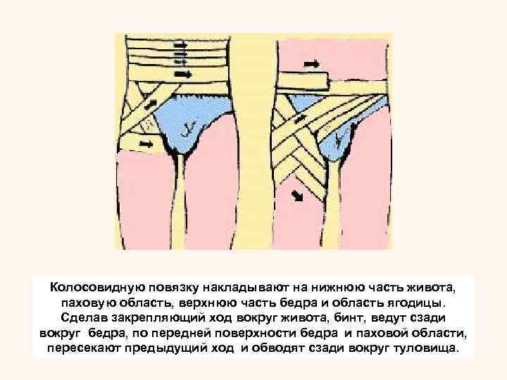 Этими ходами закрывают бинтуемую область живота, и конец   закрепляют круговым ходом вокруг