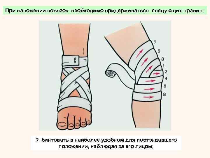  Ø бинт, обычно, держат в правой руке, а левой удерживают повязку и расправляют