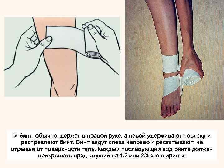   Ø бинтовать руку при согнутом под небольшим углом локтевом суставе, а ногу