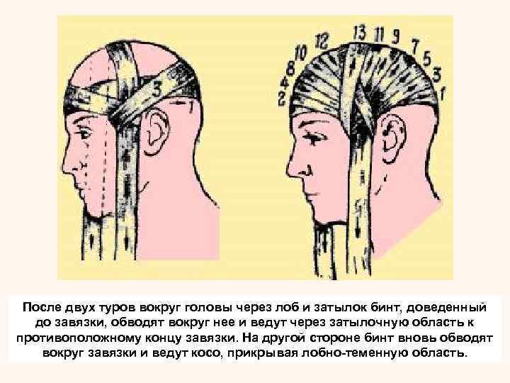 Туалет ран наложение основных видов повязок