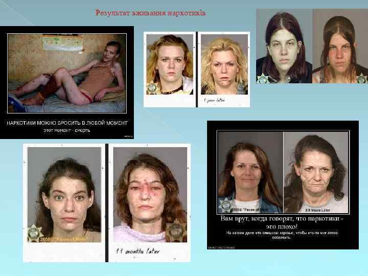 Результат вживання наркотиків 