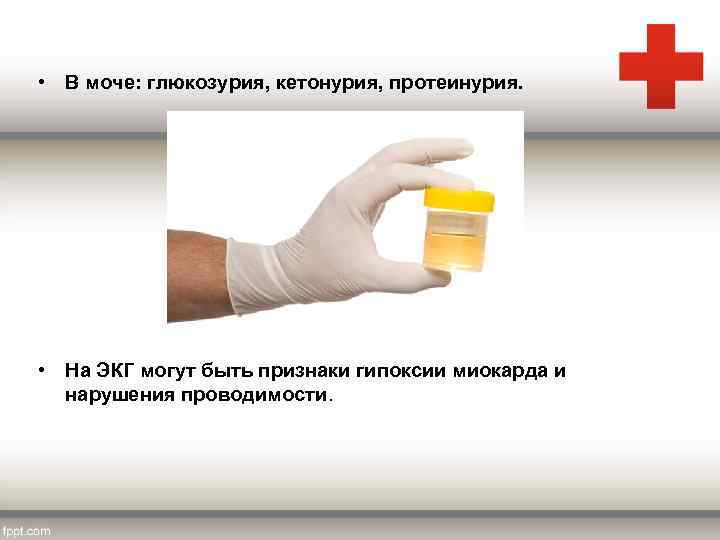  • В моче: глюкозурия, кетонурия, протеинурия. • На ЭКГ могут быть признаки гипоксии