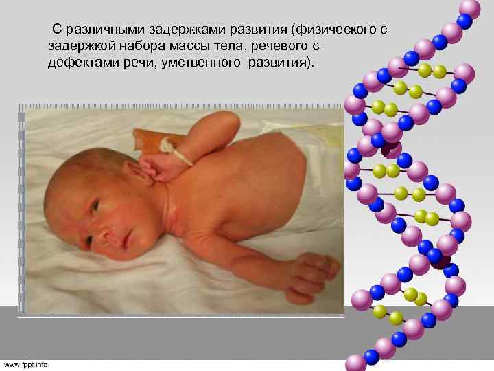  С различными задержками развития (физического с задержкой набора массы тела, речевого с дефектами