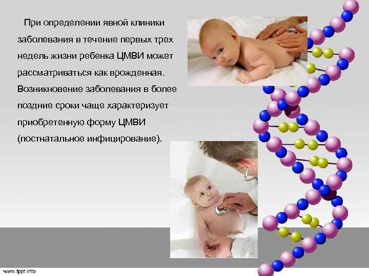  При определении явной клиники заболевания в течение первых трех недель жизни ребенка ЦМВИ