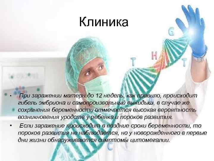 Клиника • При заражении матери до 12 недель, как правило, происходит гибель эмбриона и