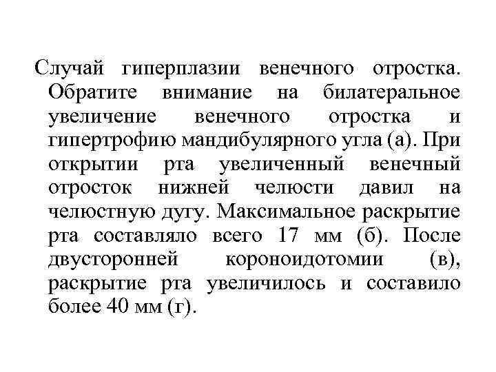  Случай гиперплазии венечного отростка. Обратите внимание на билатеральное увеличение венечного отростка и гипертрофию