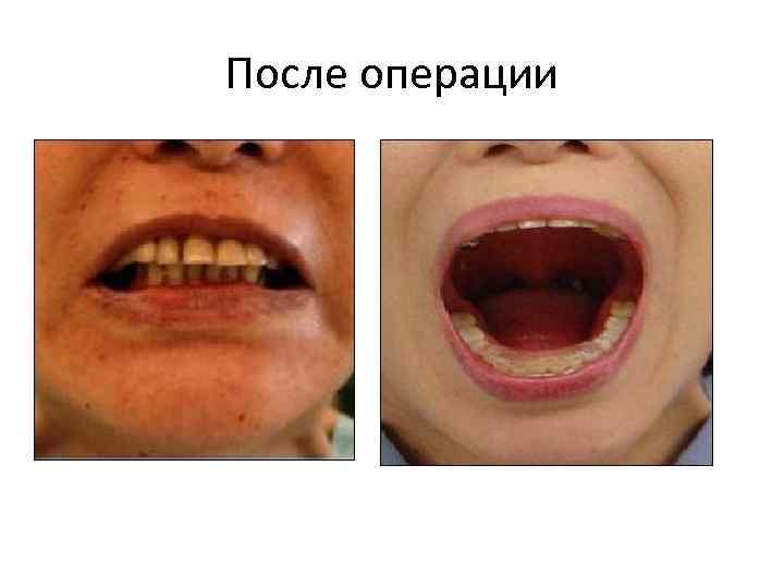 После операции 