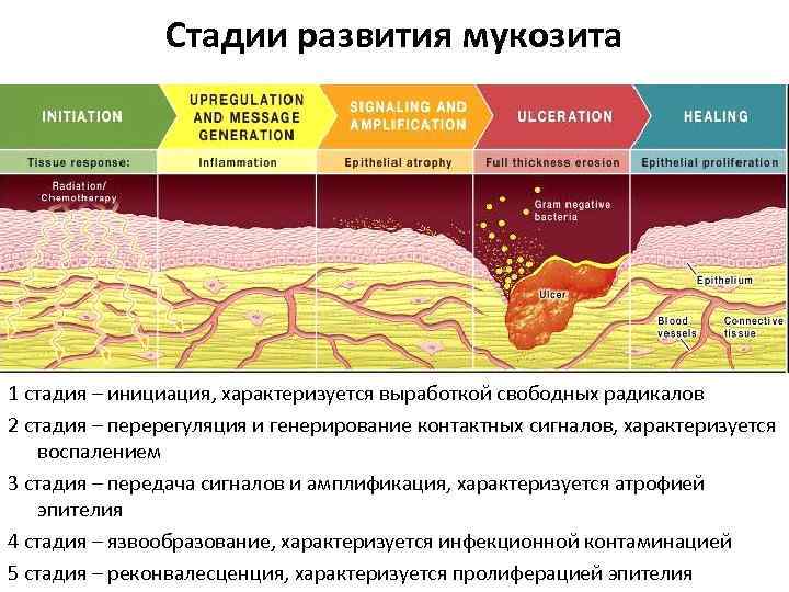 Мукозит после имплантации схема лечения