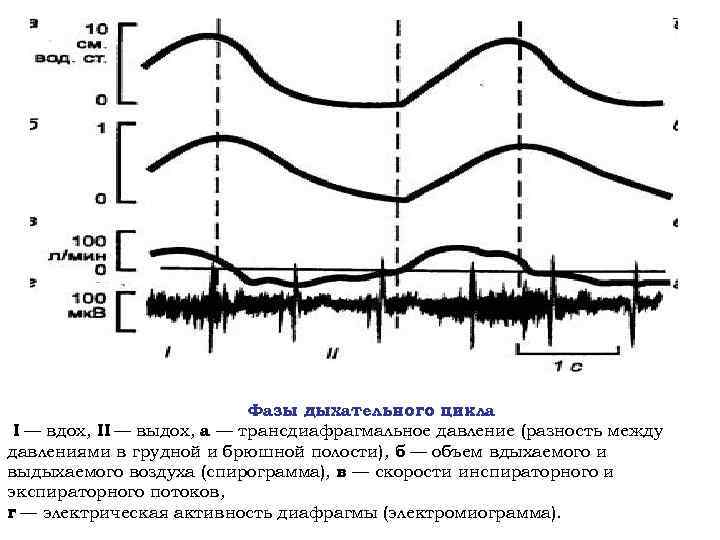 Фазы дыхательного цикла I — вдох, II — выдох, а — трансдиафрагмальное давление (разность