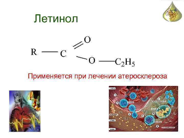 Летинол Применяется при лечении атеросклероза 