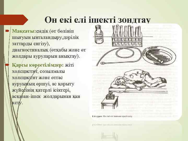 Он екі елі ішекті зондтау Мақсаты: емдік (өт бөлініп шығуын ынталандыру, дәрілік заттарды енгізу),