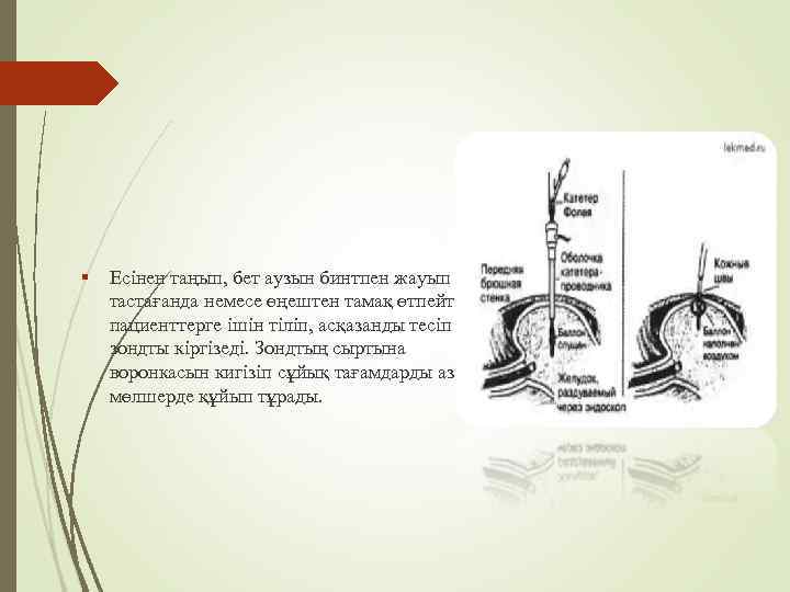  Есінен таңып, бет аузын бинтпен жауып тастағанда немесе өңештен тамақ өтпейтін пациенттерге ішін