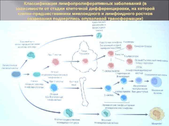 Классификация лимфопролиферативных заболеваний (в зависимости от стадии клеточной дифференцировки, на которой клетки-предшественники миелоидного и
