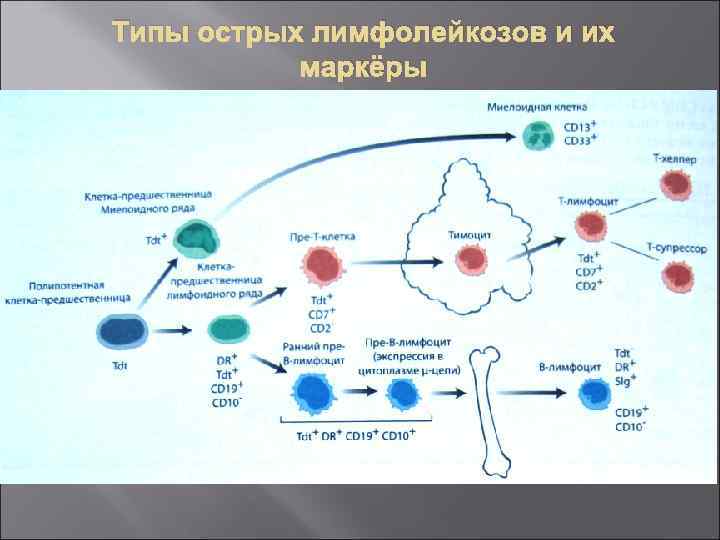 Типы острых лимфолейкозов и их маркёры 