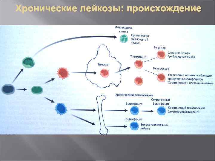 Хронические лейкозы: происхождение 