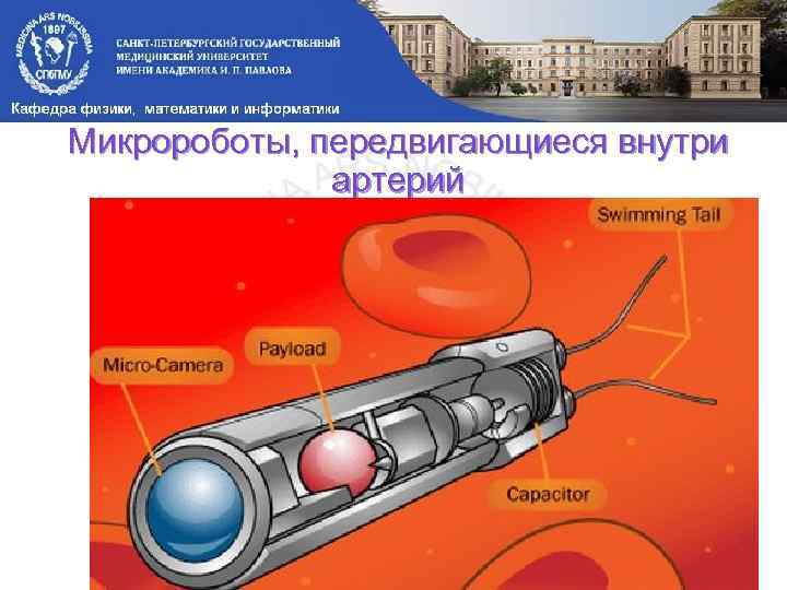 Микророботы, передвигающиеся внутри артерий 