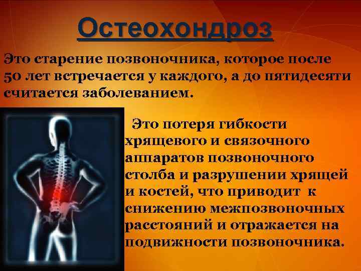 Остеохондроз Это старение позвоночника, которое после 50 лет встречается у каждого, а до пятидесяти