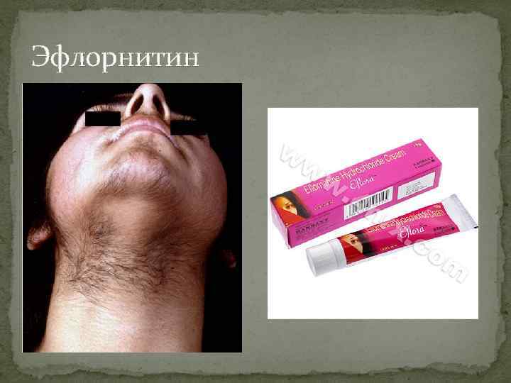 Эфлорнитин 