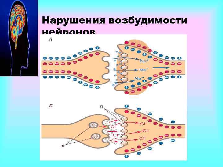 Нарушения возбудимости нейронов 