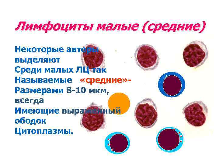 Лимфоциты малые (средние) Некоторые авторы выделяют Среди малых ЛЦ так Называемые «средние» Размерами 8
