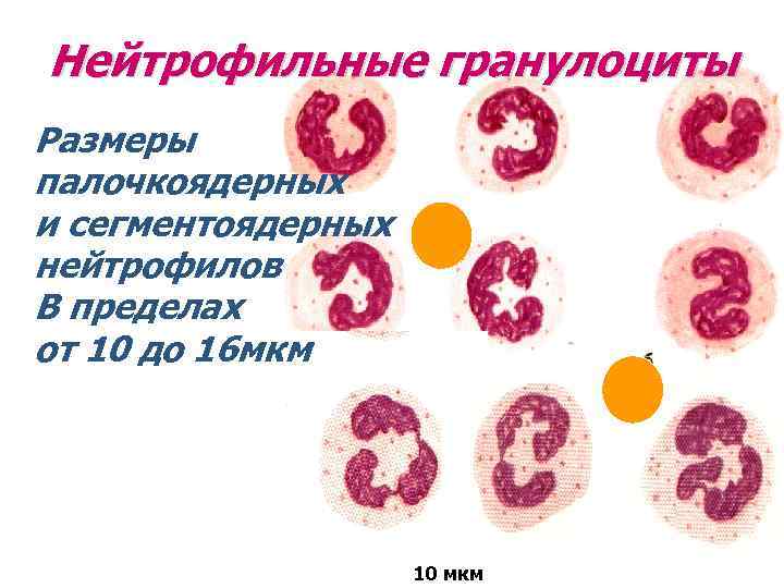 Нейтрофильные гранулоциты Размеры палочкоядерных и сегментоядерных нейтрофилов В пределах от 10 до 16 мкм