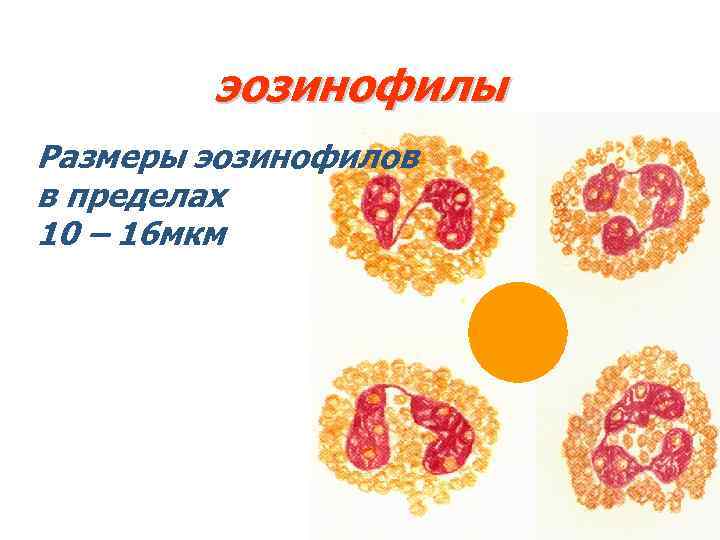 эозинофилы Размеры эозинофилов в пределах 10 – 16 мкм 