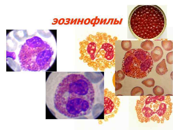 эозинофилы 
