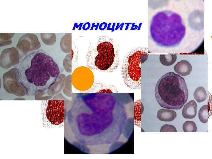 моноциты 