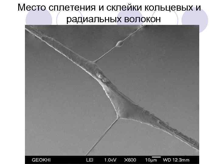 Место сплетения и склейки кольцевых и радиальных волокон 