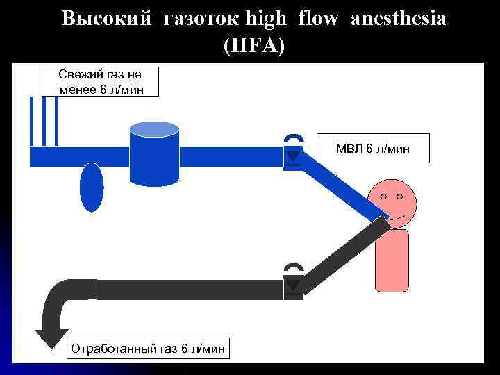 Высокий газоток high flow anesthesia (HFA) Свежий газ не менее 6 л/мин МВЛ 6