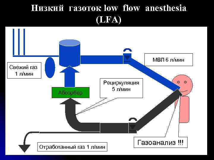 Низкий газоток low flow anesthesia (LFA) МВЛ 6 л/мин Свежий газ 1 л/мин Абсорбер