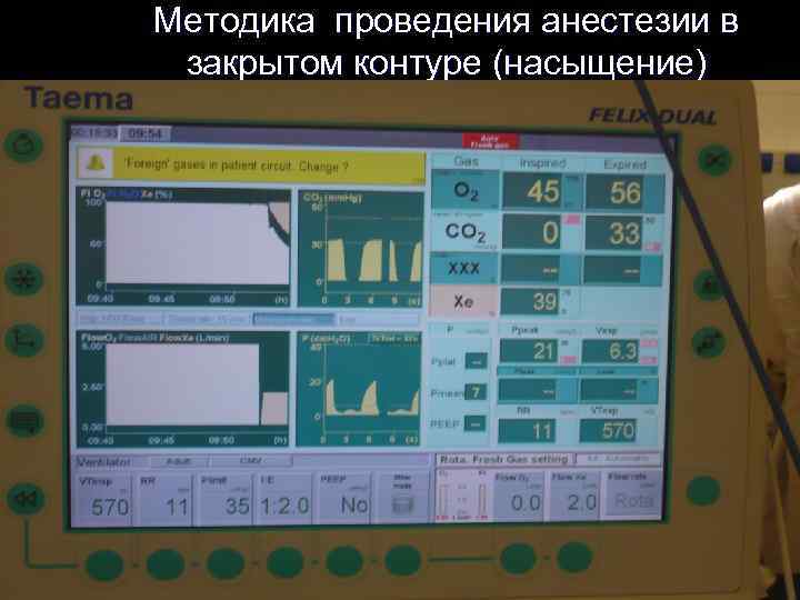 Методика проведения анестезии в закрытом контуре (насыщение) 