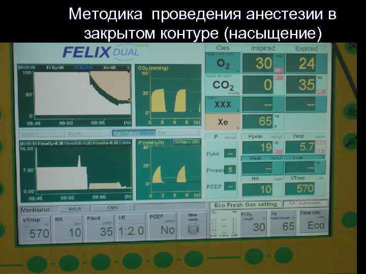 Методика проведения анестезии в закрытом контуре (насыщение) 