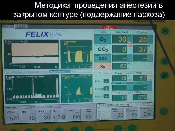  Методика проведения анестезии в закрытом контуре (поддержание наркоза) 