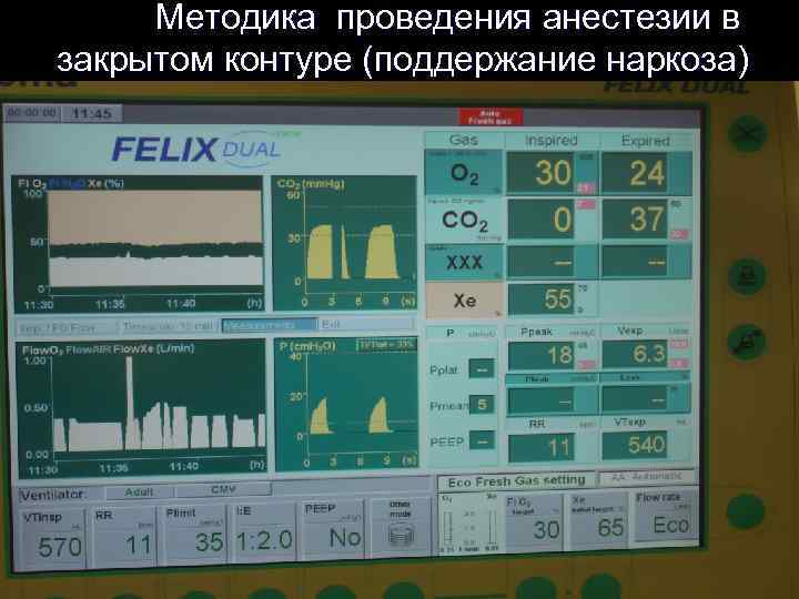  Методика проведения анестезии в закрытом контуре (поддержание наркоза) 