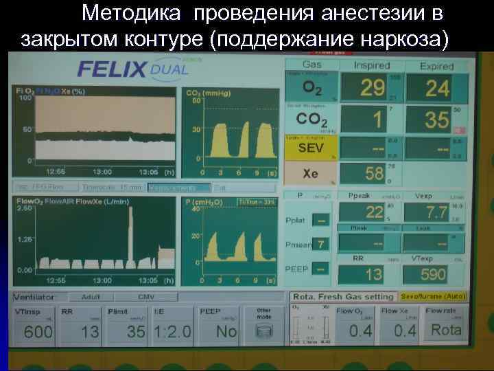 Карта проведения анестезиологического пособия